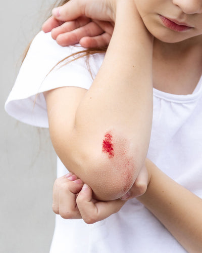 Child with a scraped arm showing a red mark on a plain background