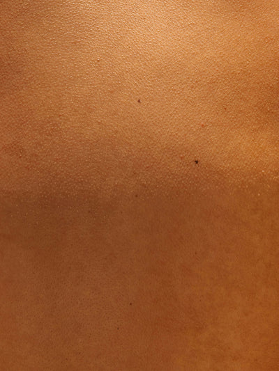 Close up of skin texture